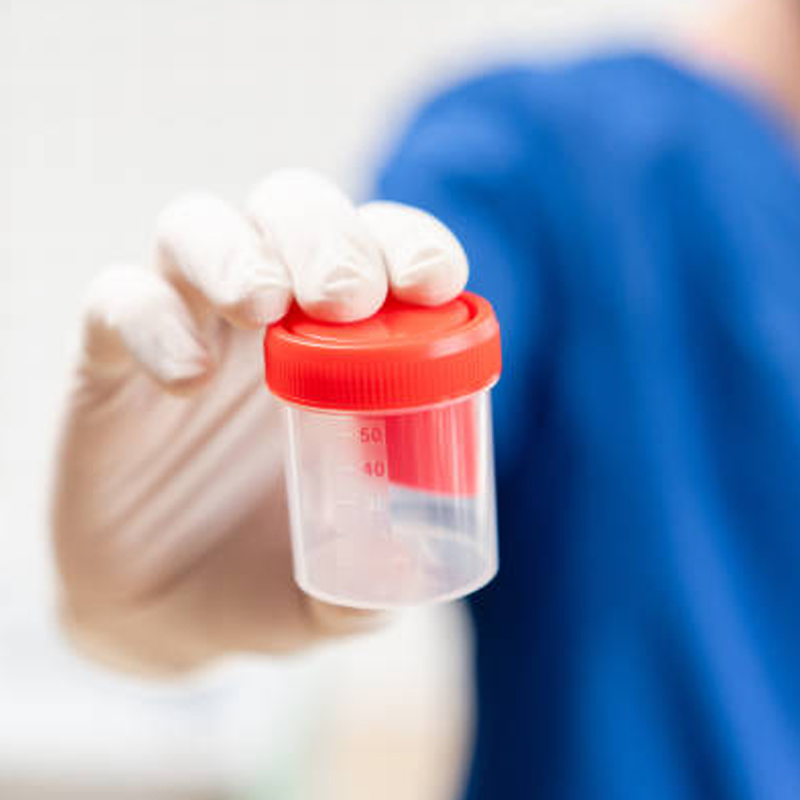 Male Fertility & Semen Analysis